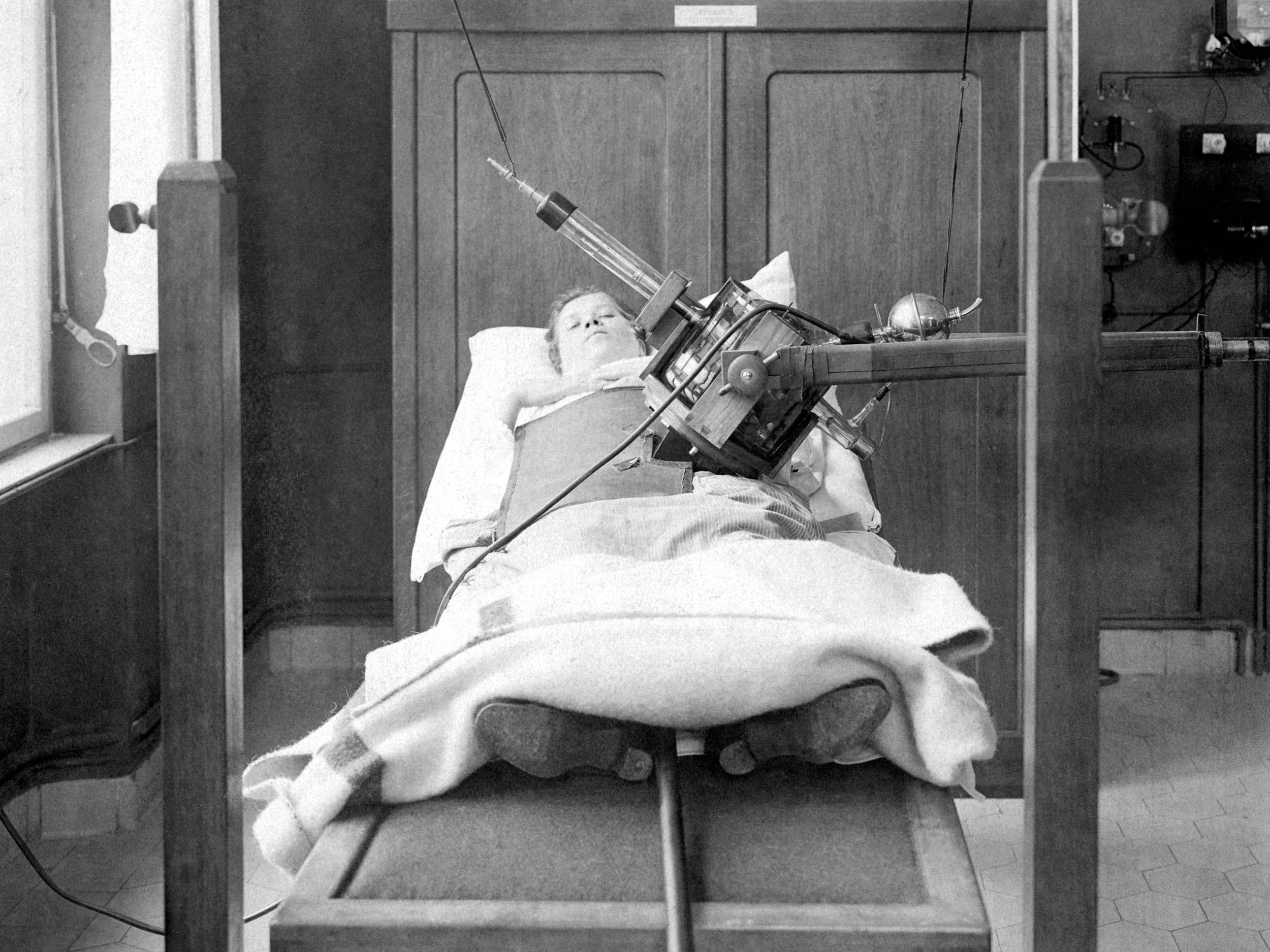 Fotografie, schwarz-weiß, von 1918: Das Foto zeigt eine liegende Frau auf einer Holzliege. Ein Bestrahlungsgerät bestrahlt die linke Seite ihres unteren Leibs.   Die rechte Seite ist abgedeckt. Im Hintergrund sieht man einen Holzschrank und verschiedene Apparaturen.